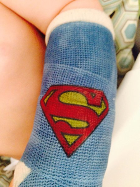 Разукрашенный гипс на руке