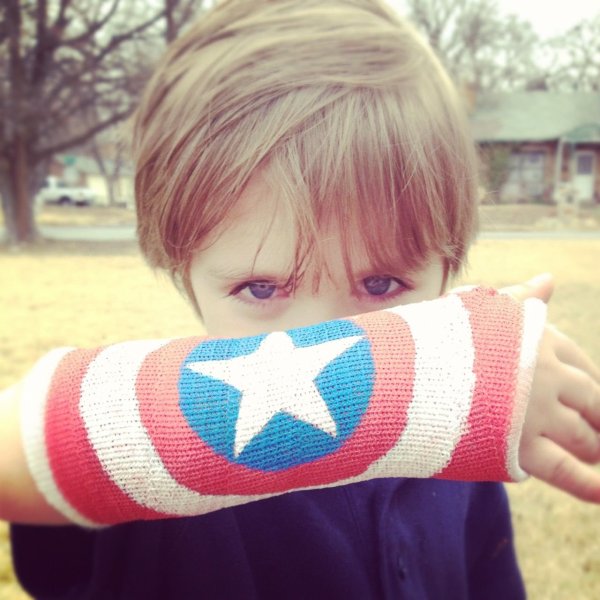 Смешные надписи на гипсе на ноге