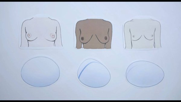 Формы груди