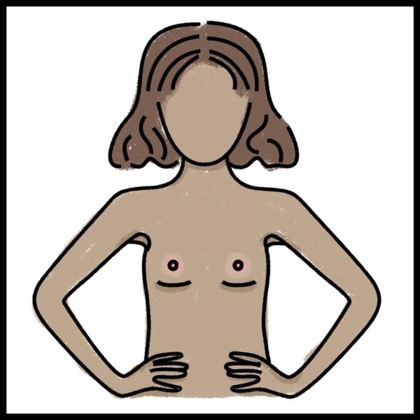 Молочные железы у девочек