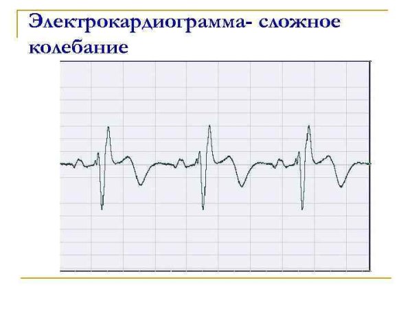 Негармонические колебания