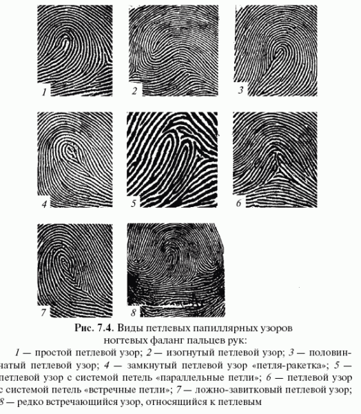 Петлевой Тип папиллярных узоров