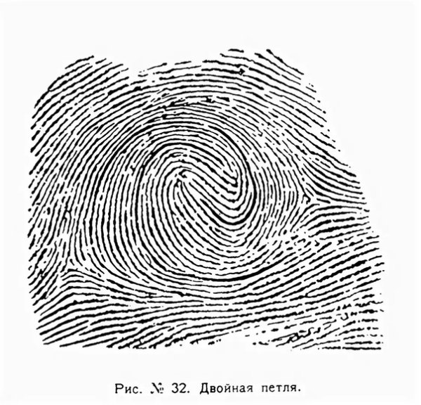 Двойная петля дерматоглифика