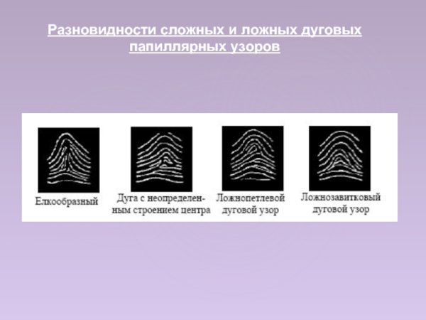 Папиллярные узоры Эдвард Генри