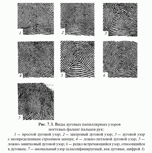 Классификация папиллярных узоров пальцев рук