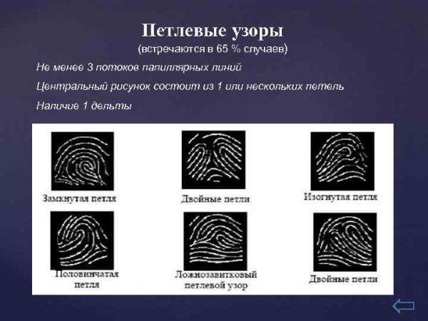 Дактилоскопия типы петлевых узоров