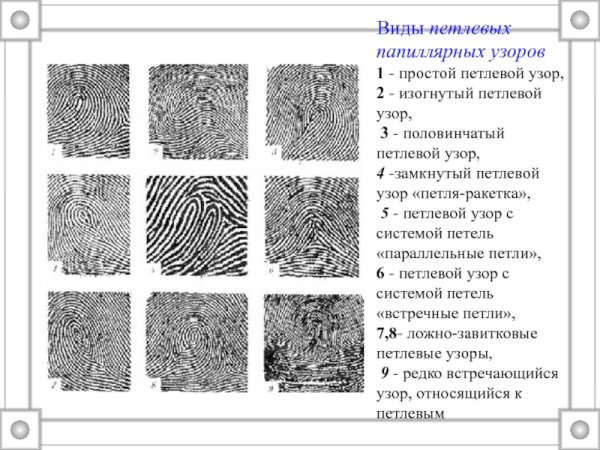 Завитковый папиллярный узор
