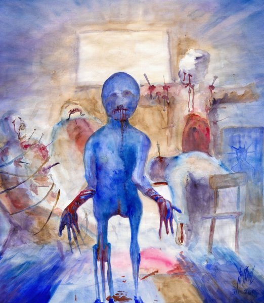 Шон Косс психические расстройства