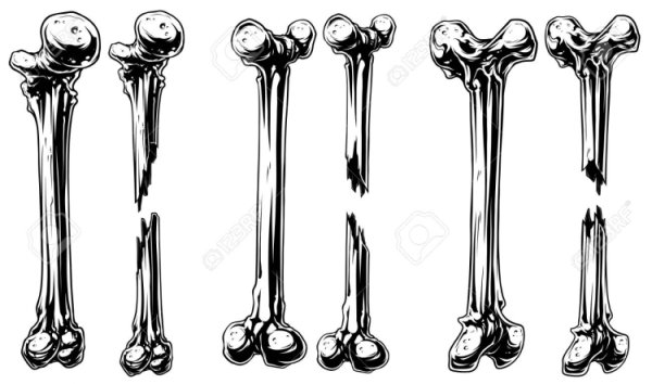 Кость черно белая