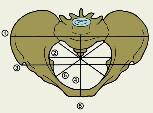 Размеры малого таза в акушерстве