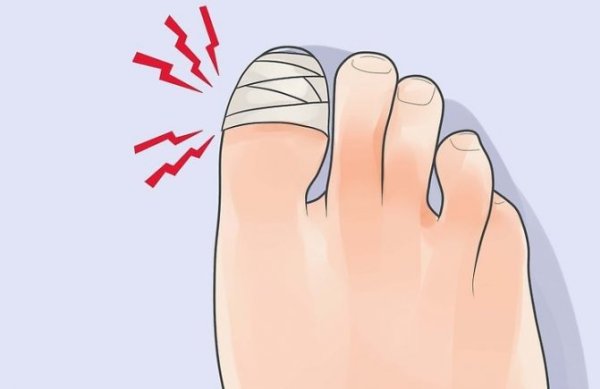 Травма большого пальца ноги