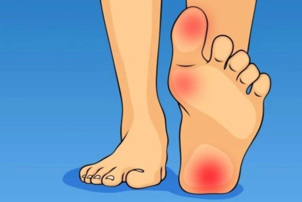 Вальгусная деформация косточки