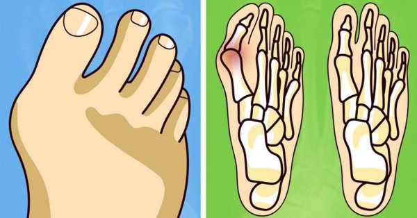 Ногти на ногах иллюстрация