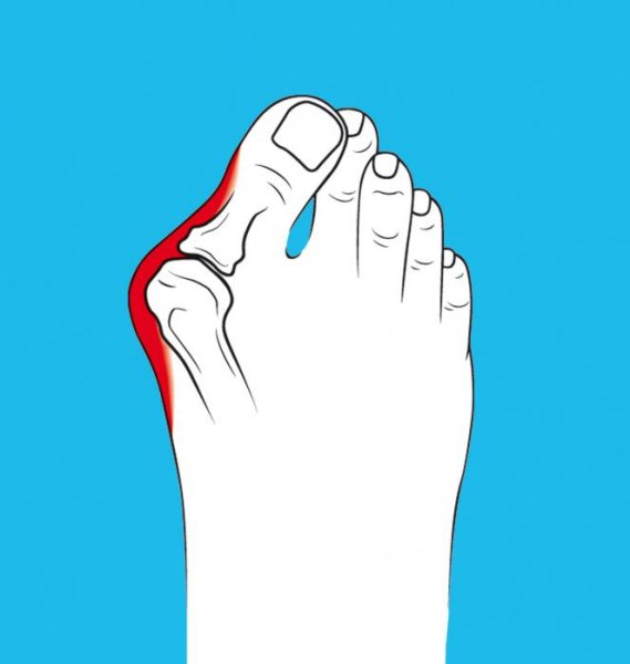 Пальцы ног мультяшные