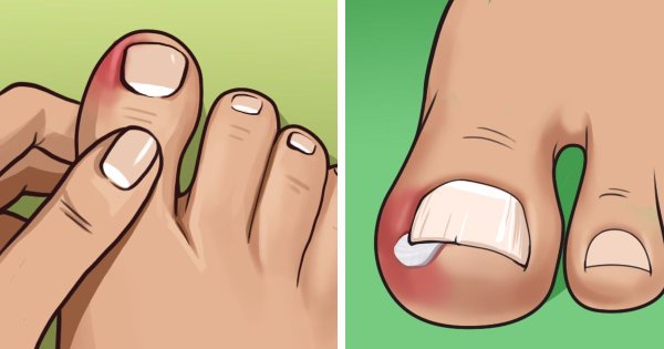 Большой палец на ноге мультяшная