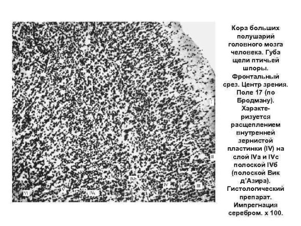 Кора полушарий гистология