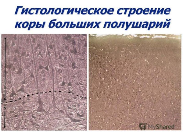 Цитоархитектоника коры головного мозга гистология препарат