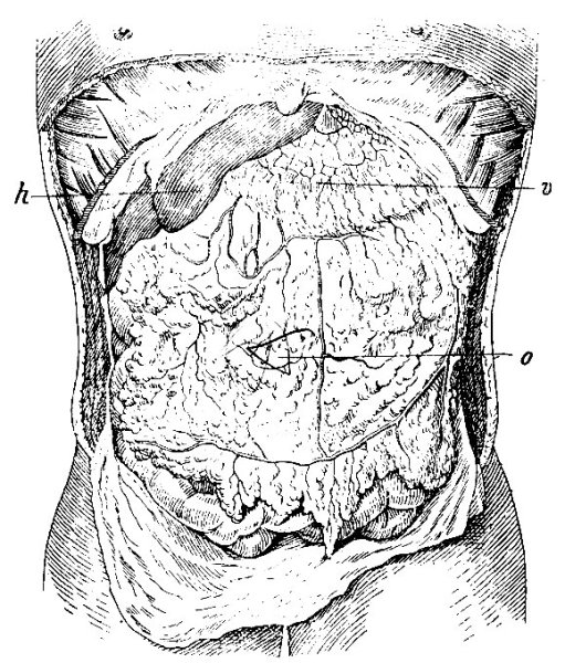 Большой сальник анатомия человека