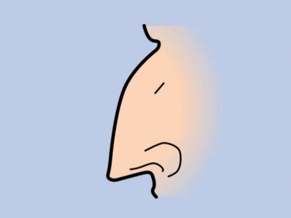 Орлиная форма носа