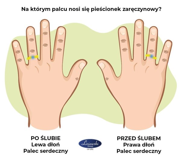 Мышцы руки с разных ракурсов