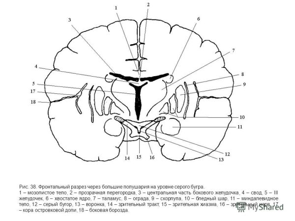 Базальные ядра больших полушарий головного мозга