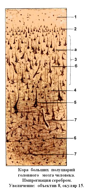 Кора больших полушарий гистология препарат