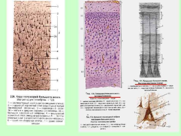 Цитоархитектоника коры головного мозга гистология