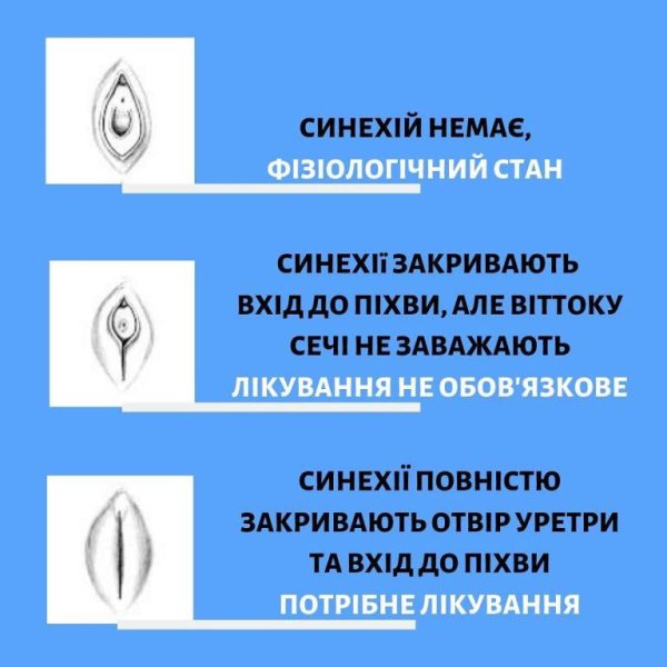 Синехии малых половых губ у девочек