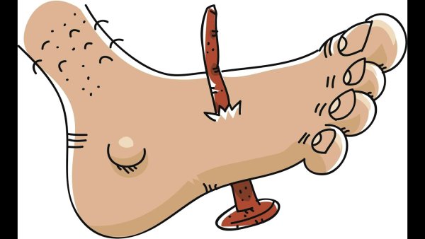 Следы человека